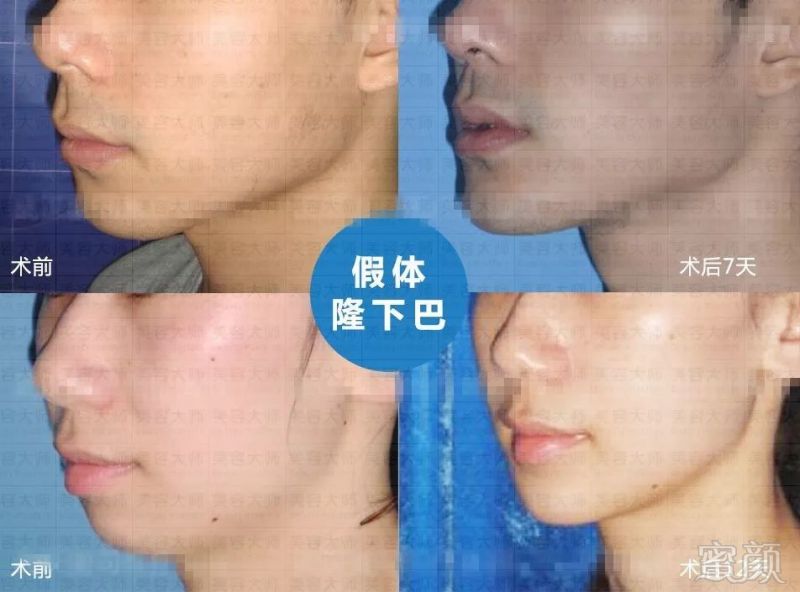 https://img.miyanlife.com/mnt/timg/181101/124405BE-12.jpg