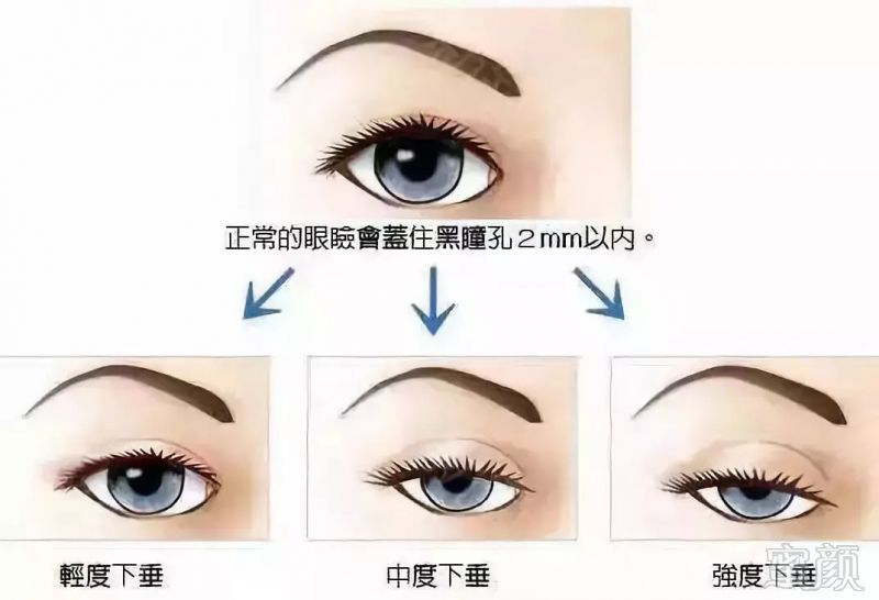 https://img.miyanlife.com/mnt/timg/181101/1249494154-10.jpg