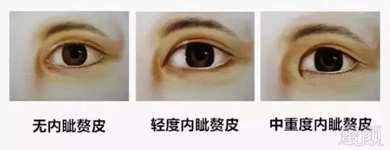 https://img.miyanlife.com/mnt/timg/181101/1249494462-7.jpg