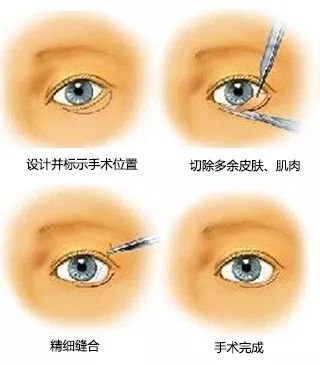 https://img.miyanlife.com/mnt/timg/181101/1249495N7-13.jpg