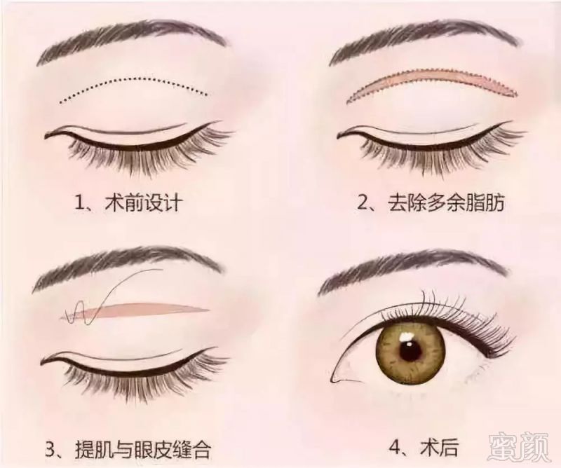 https://img.miyanlife.com/mnt/timg/181101/12494W1a-6.jpg