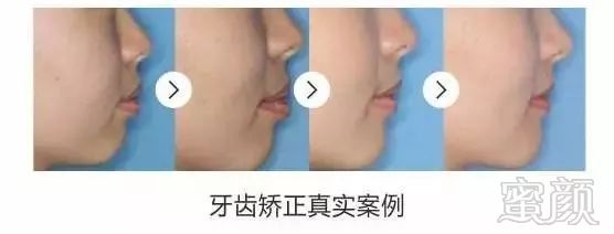 https://img.miyanlife.com/mnt/timg/181101/12531Uc2-12.jpg