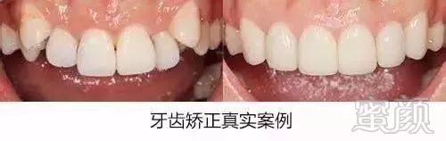 https://img.miyanlife.com/mnt/timg/181101/12531W264-11.jpg