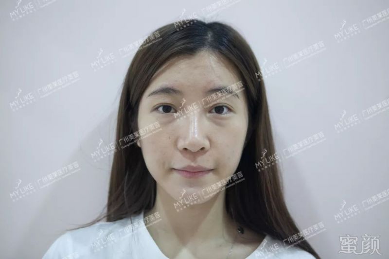 https://img.miyanlife.com/mnt/timg/181102/1143142c5-5.jpg