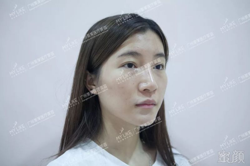 https://img.miyanlife.com/mnt/timg/181102/1143151127-6.jpg