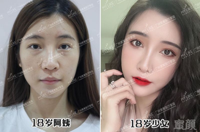 https://img.miyanlife.com/mnt/timg/181102/11432H5B-15.jpg