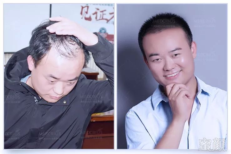 https://img.miyanlife.com/mnt/timg/181103/09463L928-7.jpg