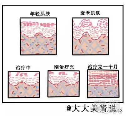 https://img.miyanlife.com/mnt/timg/181103/094JTJ4-4.jpg
