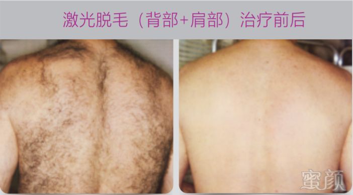 https://img.miyanlife.com/mnt/timg/181103/103KG926-4.jpg