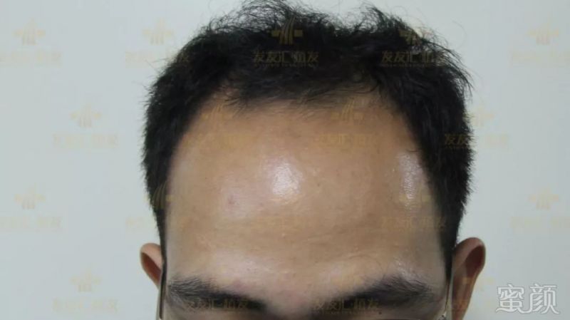 https://img.miyanlife.com/mnt/timg/181103/103U91S8-6.jpg