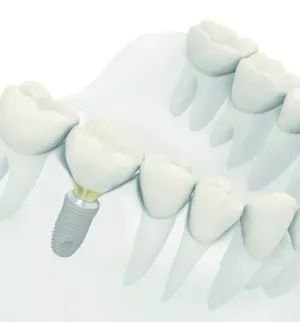 https://img.miyanlife.com/mnt/timg/181103/11053V406-3.jpg