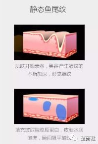 https://img.miyanlife.com/mnt/timg/181103/1111264394-12.jpg