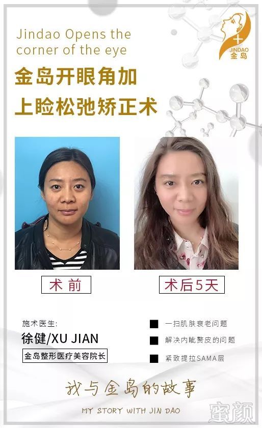 https://img.miyanlife.com/mnt/timg/181103/11131B2Q-12.jpg