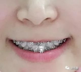 https://img.miyanlife.com/mnt/timg/181103/1114524B2-3.jpg