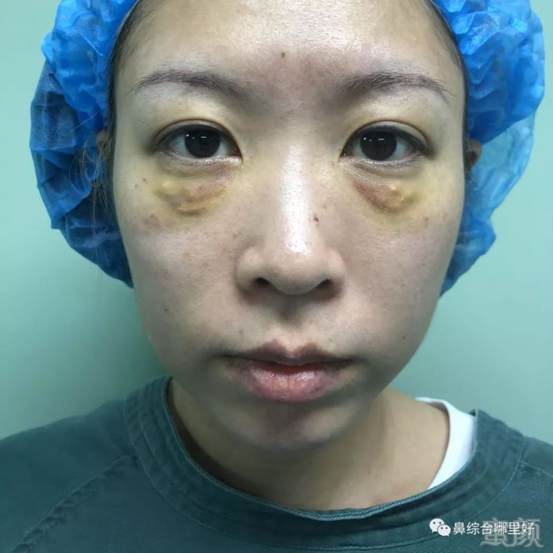 https://img.miyanlife.com/mnt/timg/181103/11354B950-0.jpg