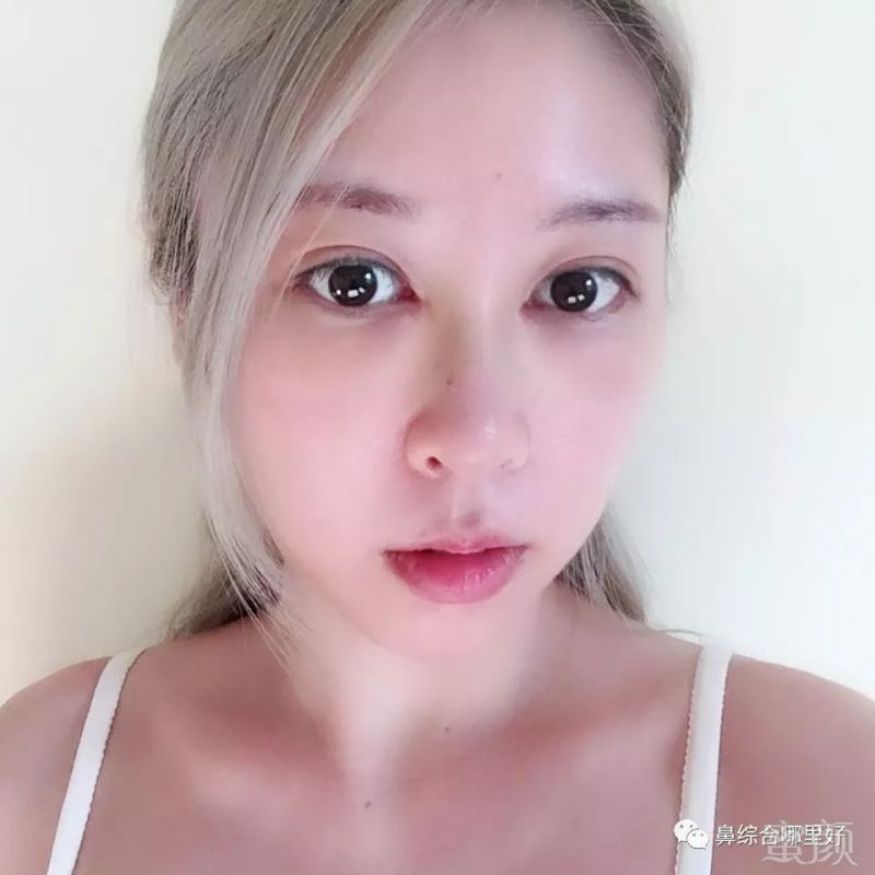 https://img.miyanlife.com/mnt/timg/181103/11354MB8-3.jpg