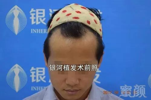 https://img.miyanlife.com/mnt/timg/181104/1231501G2-3.jpg