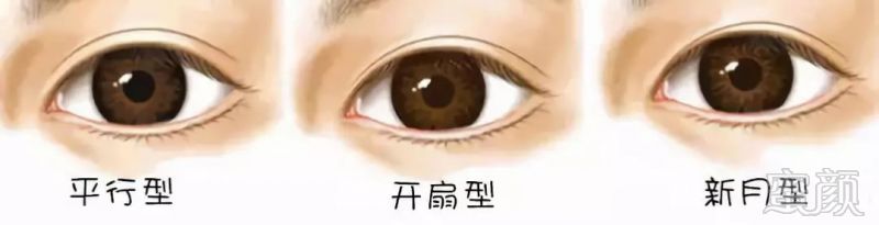 https://img.miyanlife.com/mnt/timg/181104/12424B5J-4.jpg