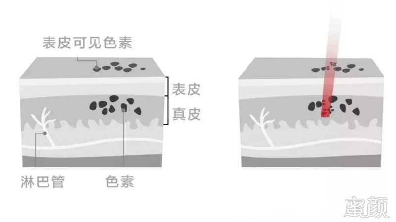 案例图片