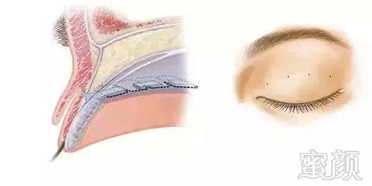 https://img.miyanlife.com/mnt/timg/181104/13005Q039-5.jpg