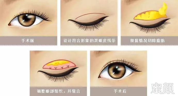https://img.miyanlife.com/mnt/timg/181104/13005RY6-6.jpg