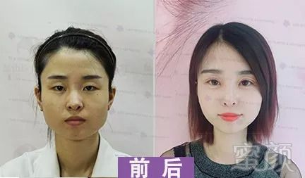 https://img.miyanlife.com/mnt/timg/181104/1301005336-11.jpg