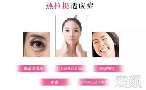 https://img.miyanlife.com/mnt/timg/181105/1129143I6-4.jpg