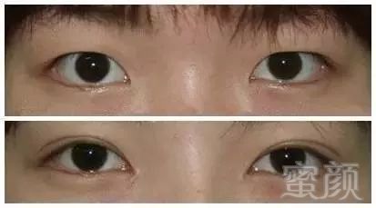 https://img.miyanlife.com/mnt/timg/181105/1139221636-7.jpg