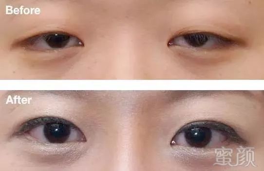 https://img.miyanlife.com/mnt/timg/181105/1139222W7-4.jpg