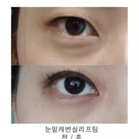 https://img.miyanlife.com/mnt/timg/181105/11400S127-5.jpg
