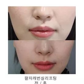 https://img.miyanlife.com/mnt/timg/181105/11400TW9-7.jpg