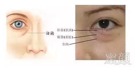 https://img.miyanlife.com/mnt/timg/181105/11400UD4-1.jpg