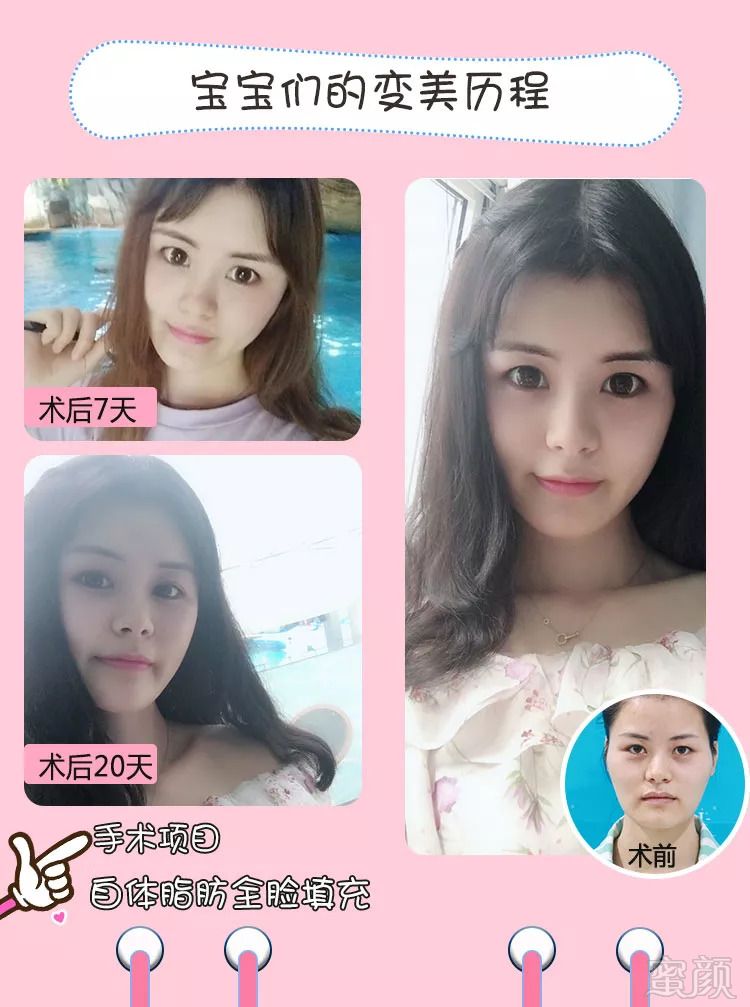 https://img.miyanlife.com/mnt/timg/181105/120SU008-3.jpg