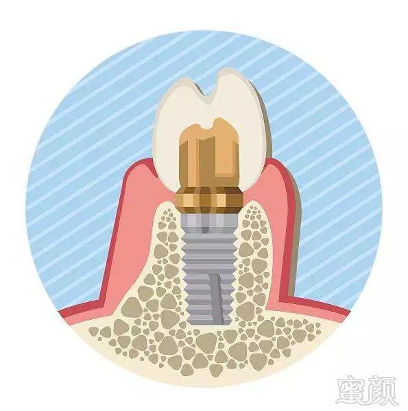 https://img.miyanlife.com/mnt/timg/181105/12194514Z-0.jpg