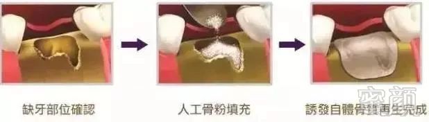 https://img.miyanlife.com/mnt/timg/181105/121945B53-1.jpg