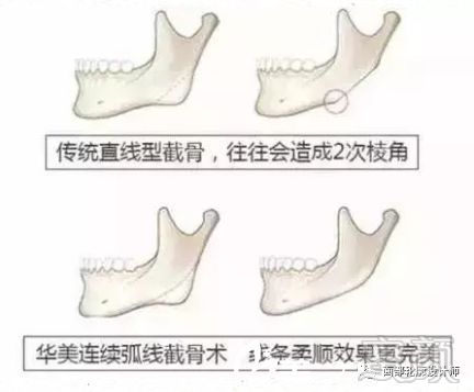 案例图片