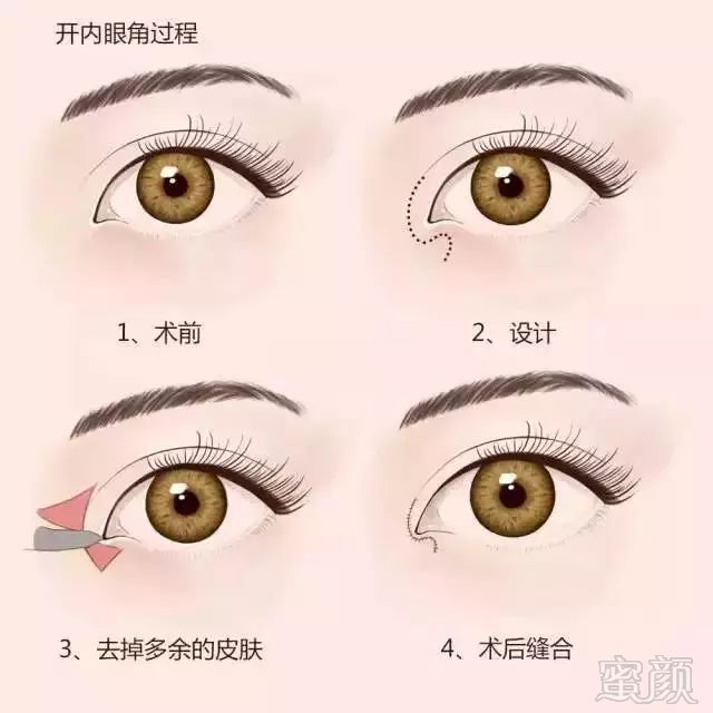 https://img.miyanlife.com/mnt/timg/181107/1104011E8-3.jpg