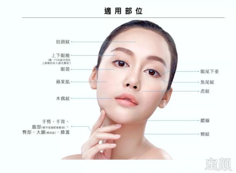 https://img.miyanlife.com/mnt/timg/181107/1112514042-9.jpg