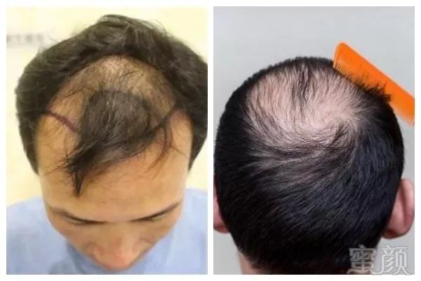 https://img.miyanlife.com/mnt/timg/181107/11295454L-1.jpg