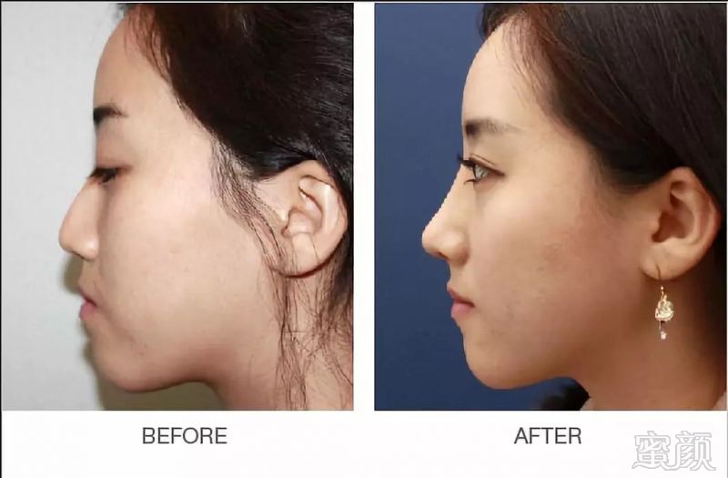 https://img.miyanlife.com/mnt/timg/181108/12021S296-5.jpg