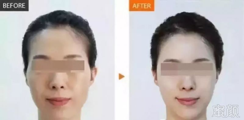 https://img.miyanlife.com/mnt/timg/181108/12141GU5-11.jpg