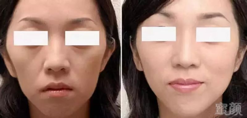 https://img.miyanlife.com/mnt/timg/181108/12141KE1-12.jpg