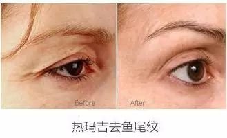 https://img.miyanlife.com/mnt/timg/181108/12162L929-5.jpg