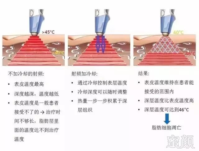 案例图片