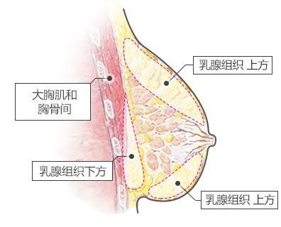 案例图片