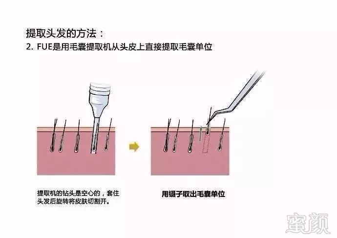 https://img.miyanlife.com/mnt/timg/181109/112FQ1E-4.jpg