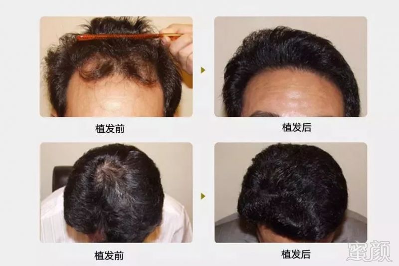 https://img.miyanlife.com/mnt/timg/181109/112FQS1-5.jpg