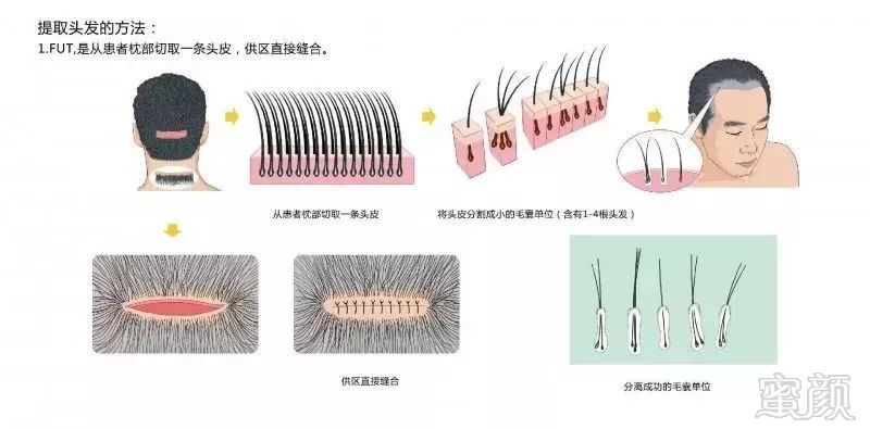 https://img.miyanlife.com/mnt/timg/181109/112FT421-3.jpg