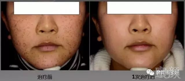 https://img.miyanlife.com/mnt/timg/181109/1233201B6-2.jpg