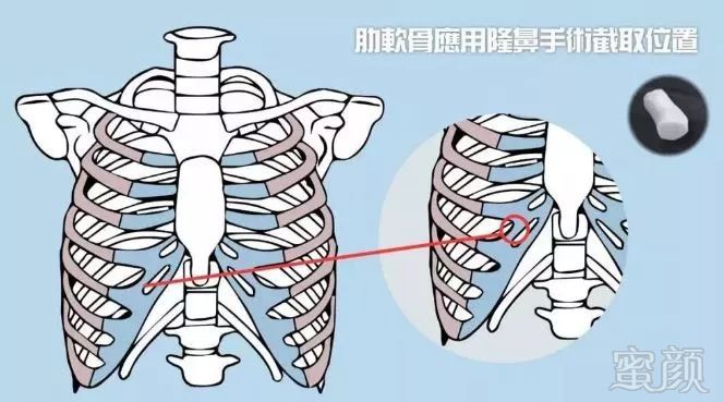 案例图片